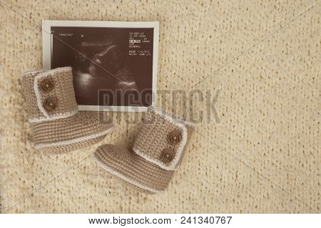 Ultrasonography Snapshot Of Baby And Knitted Booties On Warm Soft Knitted Background. Cozy, Warm Win