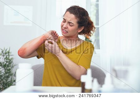 Awful Itchiness. Young Woman Looking Desperate And Sore While Applying Some Daily Medical Procedures