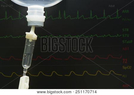 Intravenous Saline Fluid In A Plastic Bottle In Operating Room And Monitoring Display On Background