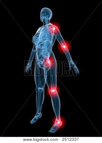 X-ışını anatomisi-ağrılı eklem