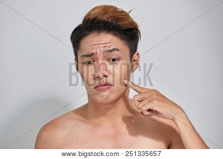 Attractive Youthful Naked Male With Trouble Skin.