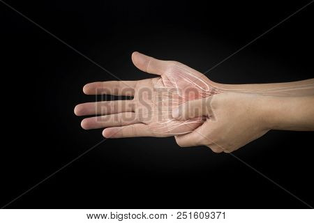 Wrist Muscle Pain White Background Wrist Pain