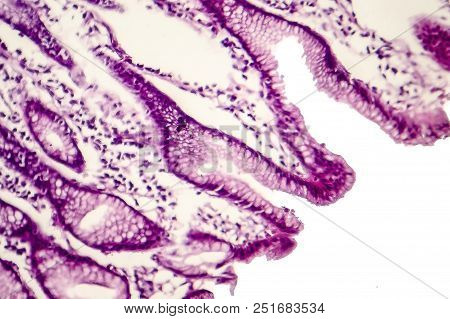 Intestinal Metaplasia Of Stomach, Light Micrograph, Photo Under Microscope