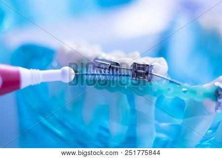 Interdental Teeth Brackets Clean