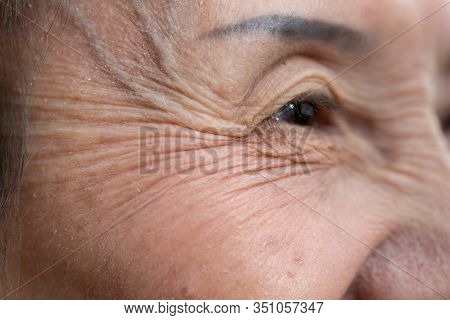 Old Woman Of Wrinkles On Her Face,close Up Skin Texture With Wrinkles On Face