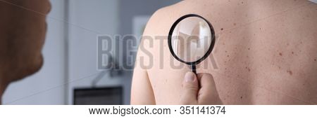 Male Doctor Look At Magnifying Glass On Patient Skin Against Hospital Office Background. Lesions Dan