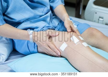 Leg Of Pcl Ligament Knee Surgery Patient Lying On Bed In Ward At Hospital With Sterile Bandage Plast