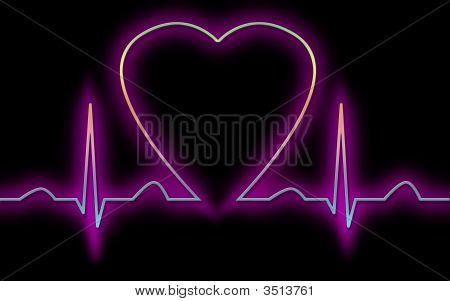 EKG