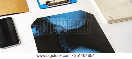 A Flat Lay Medican X-ray Scan Of Bones, Search For Diagnos On The Nurses Table