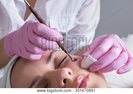 The Doctor-cosmetologist Makes The Procedure Treatment Of Couperose Of The Facial Skin Of A Beautifu