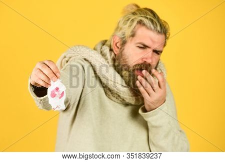 Stuffed Nose. Flu Virus. Coronavirus Outbreak. Home Treatment. Brutal Man Runny Nose. Epidemic Conce
