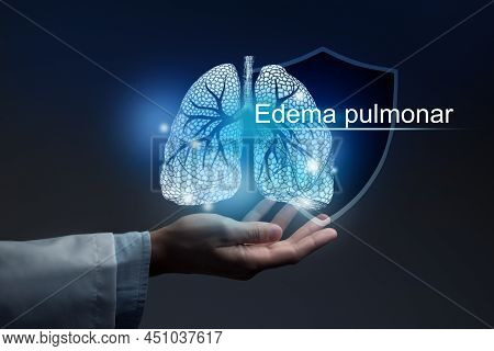 Medical Banner Pulmonary Edema With Spanish Translation Edema Pulmonar On Blue Background With Copy 