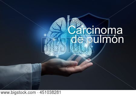 Medical Banner Carcinoma With Spanish Translation Carcinoma De Pulmón On Blue Background With Large 
