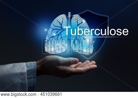 Medical Banner Tuberculosis With French Translation Tuberculose On Blue Background With Large Copy S