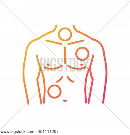 Metastases Gradient Linear Vector Icon. Chest Cancer. Thorax And Lungs Tumors. Spreading Of Cancer. 