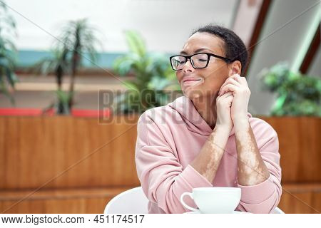 Black African American Woman With Vitiligo Pigmentation Skin Problem Indoor Dressed Pink Hoodie Glas