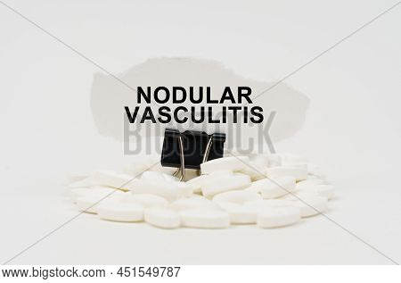 On A White Surface Are Pills And Torn Paper With The Inscription - Nodular Vasculitis