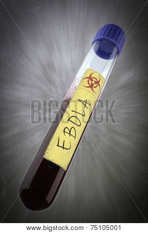 ebola blood test