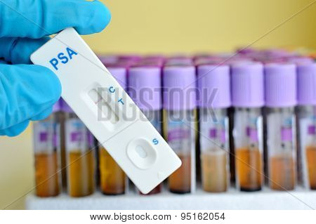 PSA negative