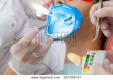 Dental Treatment In A Dental Clinic. Treatment Of Endodontic Canals With Cofferdam