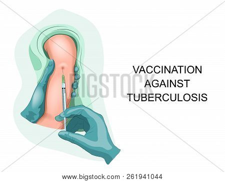 Vector Illustration Of Child Vaccination Against Tuberculosis.