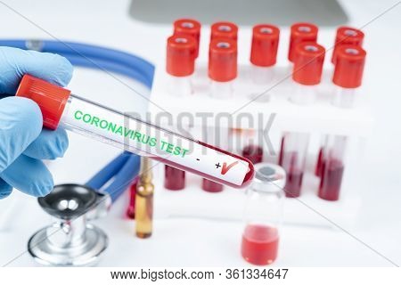 Positive Coronavirus Blood Test Concept. Analyzing Blood Sample In Test Tube For Coronavirus Test In