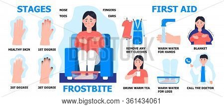 Frostbite First Aid Info-graphic Vector. Girl Is Warming Hand In Water. Hypothermia In Winter Season