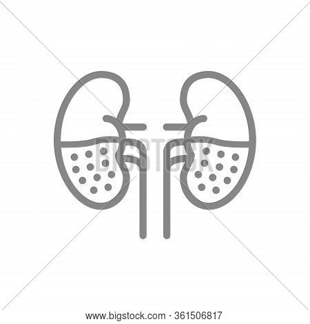 Chronic Kidney Disease Line Icon. Human Organ For Filtering Blood, Pyelonephritis, Renal Tuberculosi