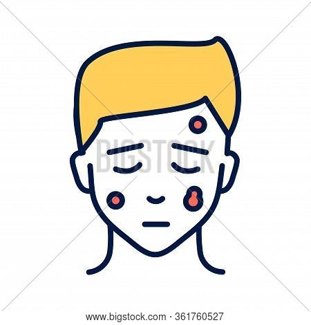 Skin Cancer Line Color Icon. Human Dermatology Disease Concept. Oncology. Isolated Vector Element. O