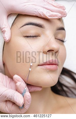 Face Lifting Pdo Suture Operation. Innovative Technique Of New Thread Lift, Cosmetologist Preparing 