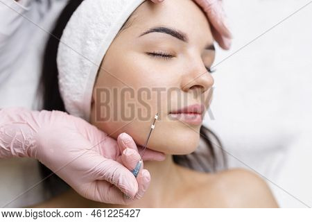 Face Lifting Pdo Suture Operation. Innovative Technique Of New Thread Lift, Cosmetologist Preparing 