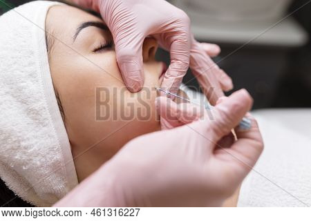 Face Lifting Pdo Suture Operation. Innovative Technique Of New Thread Lift, Cosmetologist Preparing 