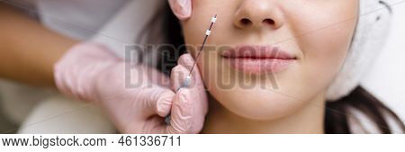 Face Lifting Pdo Suture Operation. Innovative Technique Of New Thread Lift, Cosmetologist Preparing 
