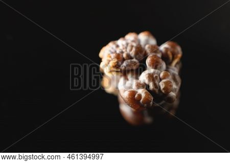 Macro Extreme Nephrolithiasis - Close-up Of A Kidney Stone Renal Calculus Or Nephrolitis On A Black 