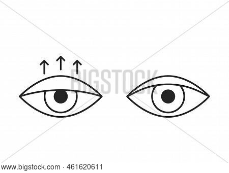 Comparison Eye With Down Lid Ptosis And Healthy Eyelid, Line Icon. Blepharoplasty, Eyelid Surgery. C