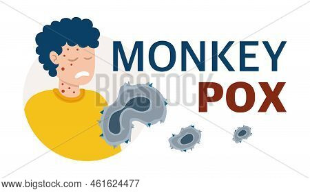 Monkey Pox Virus Poster To Inform About The Pandemic And Spread Of The Disease Images Of Human Virus