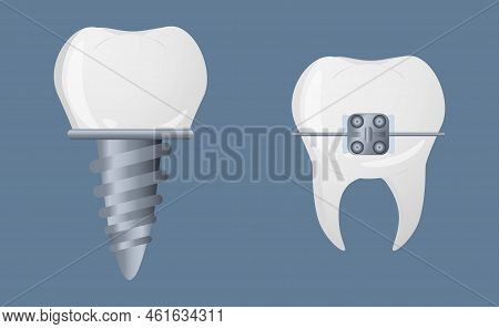 Teeth In Realistic Style. Dental Details Icons. Colorful Vector Illustration Isolated On Background.