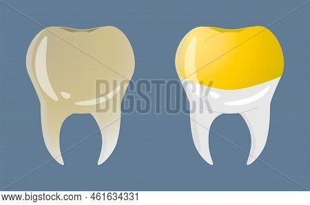 Teeth In Realistic Style. Yellow Teeth Icons. Colorful Vector Illustration Isolated On Background.