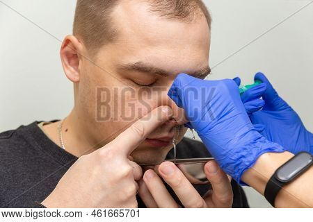 A Nurse Rinses The Nasal Cavity Of A Patient