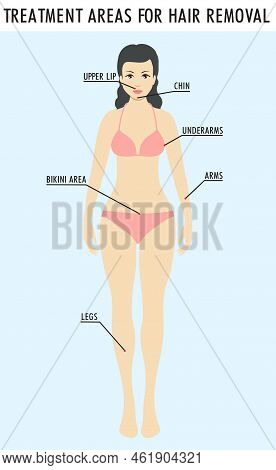 Removal Female Zones. Vector Illustration Epilation, Symbol Of Depilation Area. Rea Hair Removal, Gi