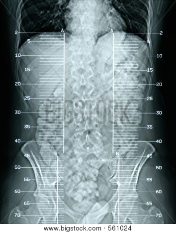 X-Ray