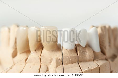 Technical shots on a dental prothetic laboratory
