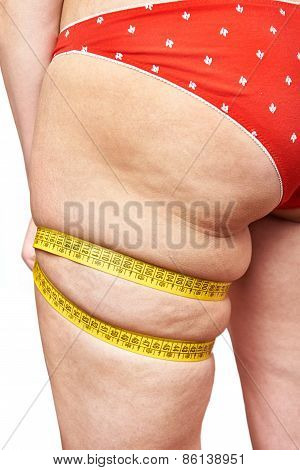 Fat Woman Measuring Thigh Leg Tape Measure