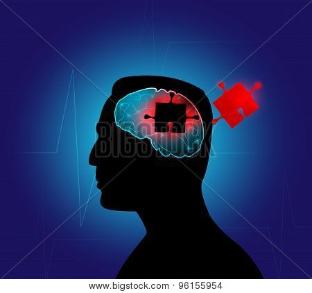 Human brain