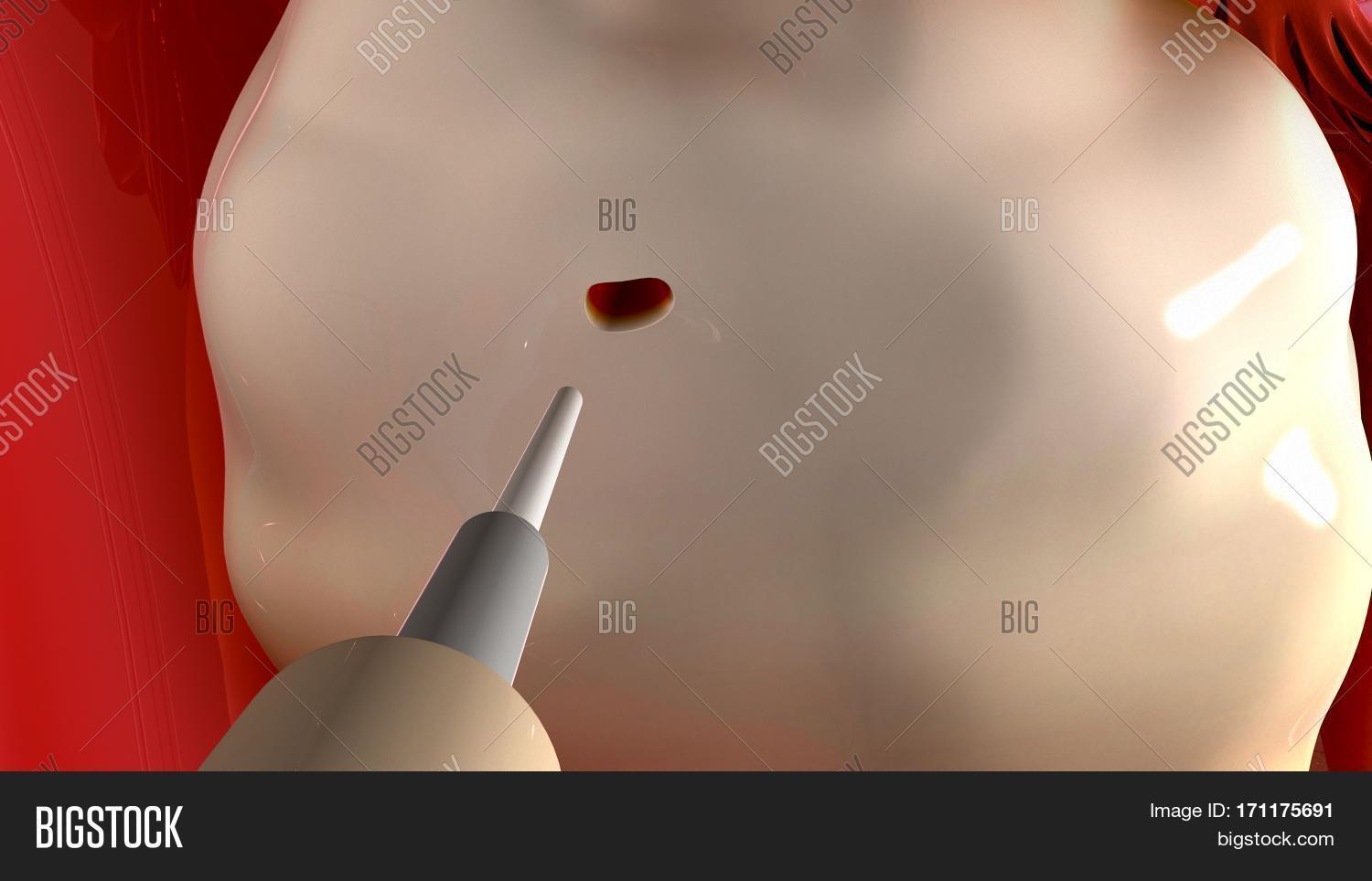 Image Preview