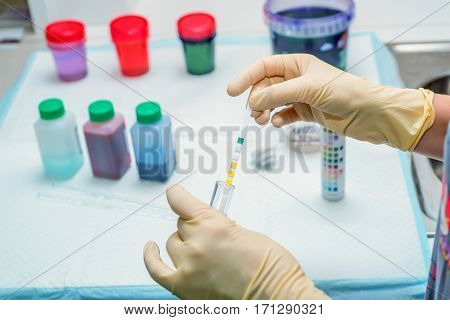 Close-up reagents for clinical urine tests in veterinary hospital