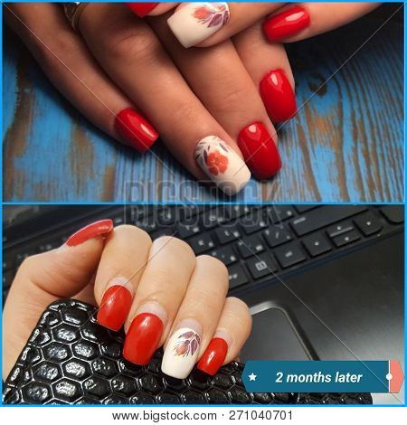 Artificial Nails Need To Be Adjusted. It Took 2 Months After Nail Extension, It Is Necessary To Make