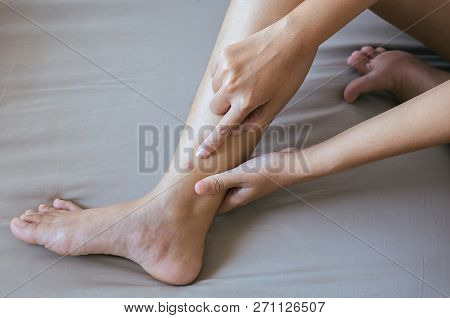 Red Mark Sensitive Skin On Leg Woman Because Mosquito Bite