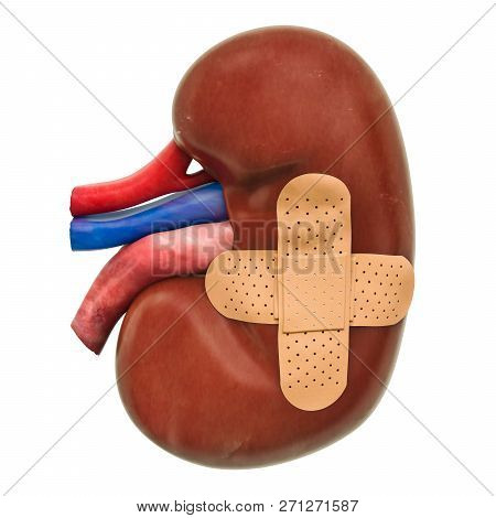 Human Kidney With Adhesive Bandages. Treatment Of Kidneys Concept, 3d Rendering Isolated On White Ba