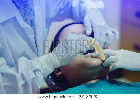 Dentist Coated Fluoride After Common Operation Of Cleaning Boy Mouth. Close-up Medical Dentist Proce